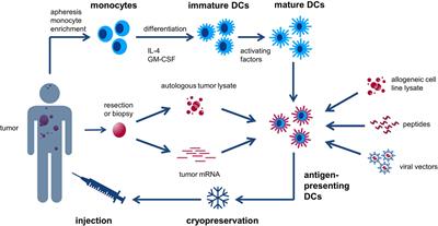 Dendritic Cell-Based Immunotherapy in Lung Cancer